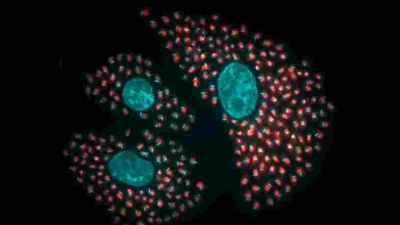 Un fármaco contra el cáncer podría ser clave para tratar el Chagas crónico