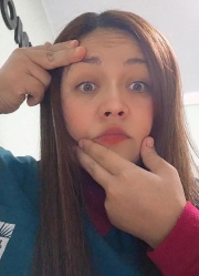 Recuperación Parálisis facial 2.jpg