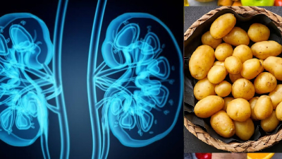 Los tres alimentos de consumo diario que afectan a los riñones