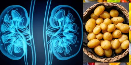 renal.jpg