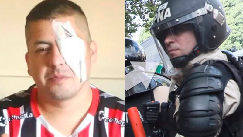 Disparo a la cara, un ojo perdido y un prefecto a juicio