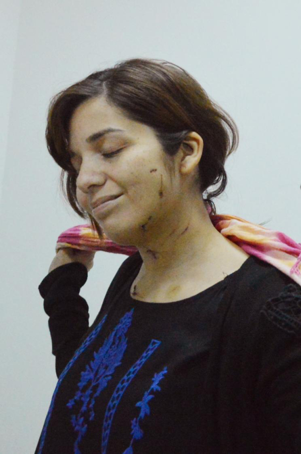 Luciana Romero en los primeros días de recuperación luego de recibir las 14 puñaladas que le propinó Germán Cazal Ortiz. NORTE hizo un registro del caso y lo siguió a lo largo del juicio. Foto: Hugo Escobar.