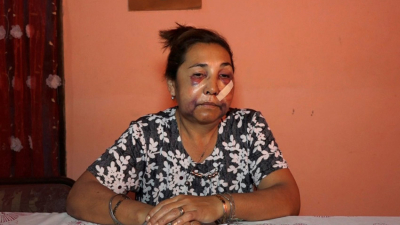 Ofelia González, la mujer que sufrió una feroz agresión espera el juicio