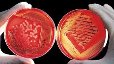 Investigan si la bacteria que causó la muerte de seis personas proviene de una cepa más virulenta