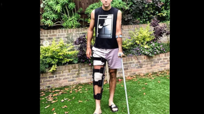 Del Potro sufrió una nueva fractura de rodilla derecha y será operado