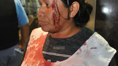 Sin tregua: Tarde de incidentes frente a Casa de Gobierno 