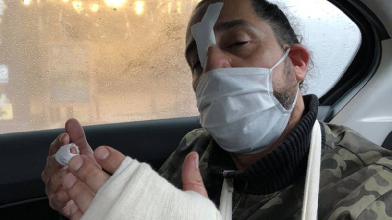Buenos Aires: murió un delincuente durante un intento de asalto a una zapatería