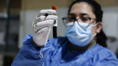 Coronavirus en Argentina: 465 muertes y 17.261 contagios en las últimas 24 horas