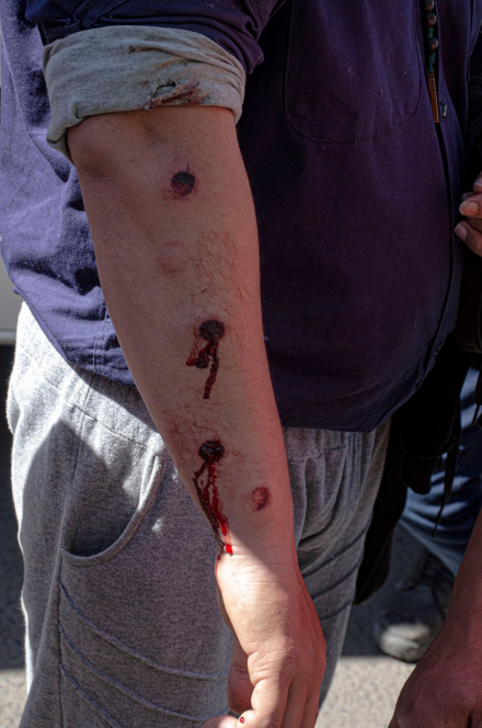 manifestante baleado.jpg
