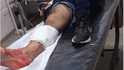 Estaba sentado en la vereda y desde un auto lo balearon pero se salvó