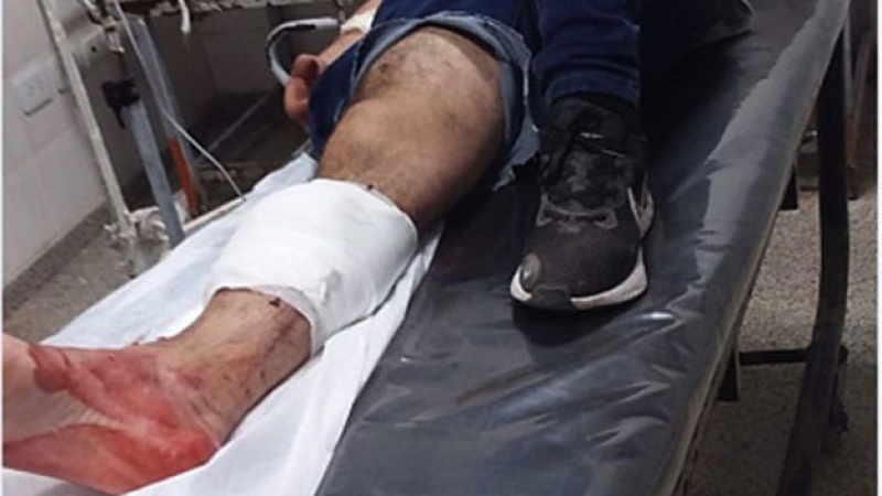Estaba sentado en la vereda y desde un auto lo balearon pero se salvó