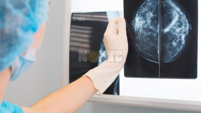 En noviembre Alcec continuará realizando mamografías gratuitas