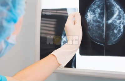 En noviembre Alcec continuará realizando mamografías gratuitas