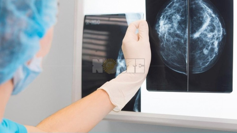 En noviembre Alcec continuará realizando mamografías gratuitas