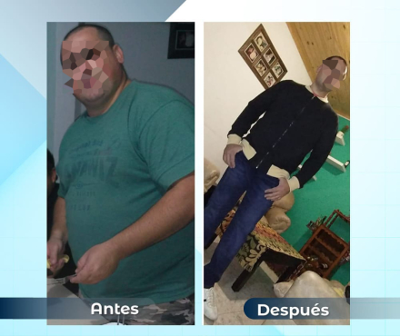 1antesydespues08.jpg