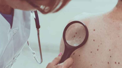 La Argentina mejoró controles de prevención de cáncer pero aún no recuperó los valores prepandemia 