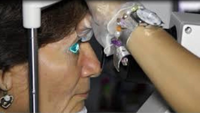 El edema macular es la principal causa de pérdida de visión en pacientes con diabetes