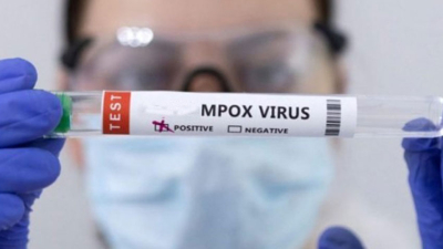 OMS: la viruela del mono ahora se llamará "mpox"