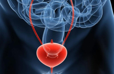 Investigadores argentinos buscan avances contra el cáncer de vejiga