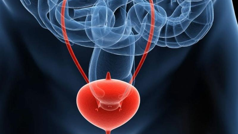 Investigadores argentinos buscan avances contra el cáncer de vejiga