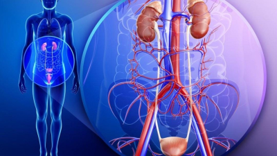 El cáncer renal suele ser detectado de manera casual
