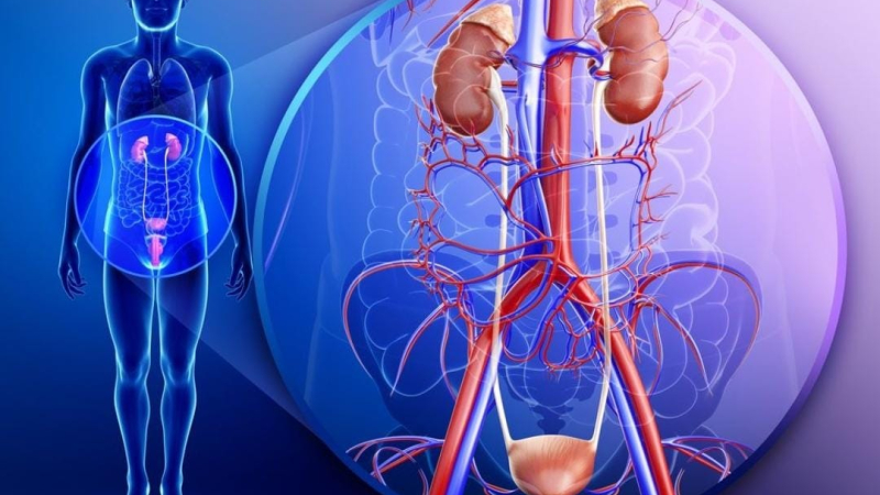 El cáncer renal suele ser detectado de manera casual