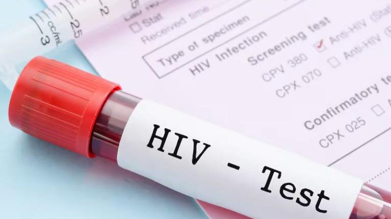 Histórica condena a un hombre que contagió a su pareja con el virus del sida