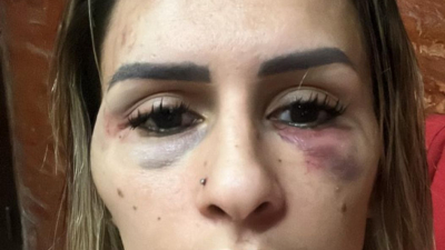Una comerciante fue brutalmente golpeada por seis mujeres