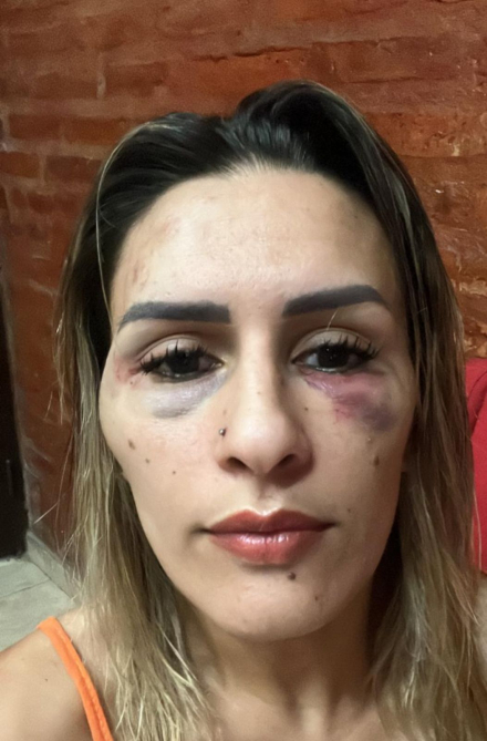 golpeada.jfif