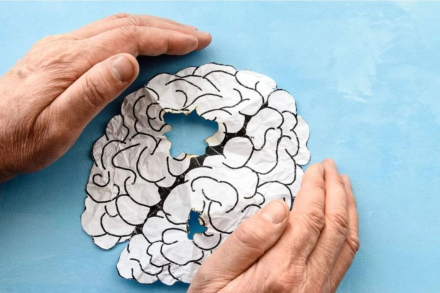 cerebro alzheimer.jpg