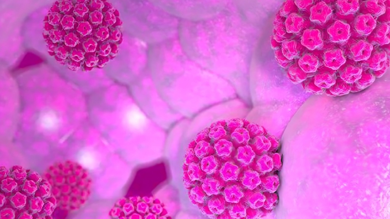 Avances en la lucha contra el virus y las lesiones precursoras del cáncer de cérvix