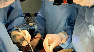 El HAC realizó un reemplazo valvular mínimamente invasivo