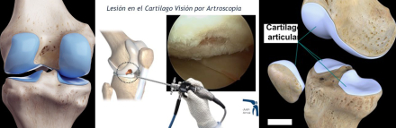 Cartílago01.jpg