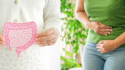 Cuáles son los 6 peores alimentos para la salud intestinal