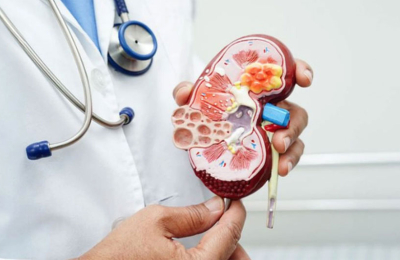 Una IA que promete frenar la epidemia silenciosa de la enfermedad renal