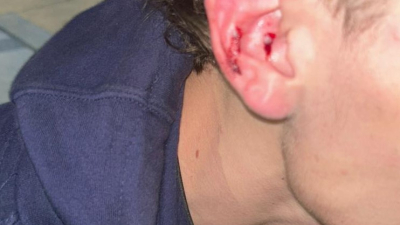 Violencia en U21: repudio general, heridos y advertencia de sanciones ejemplares