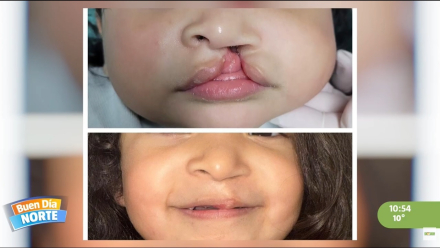 labio2